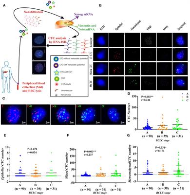 Corrigendum: Association of preoperative NANOG-positive circulating tumor cell levels with recurrence of hepatocellular carcinoma